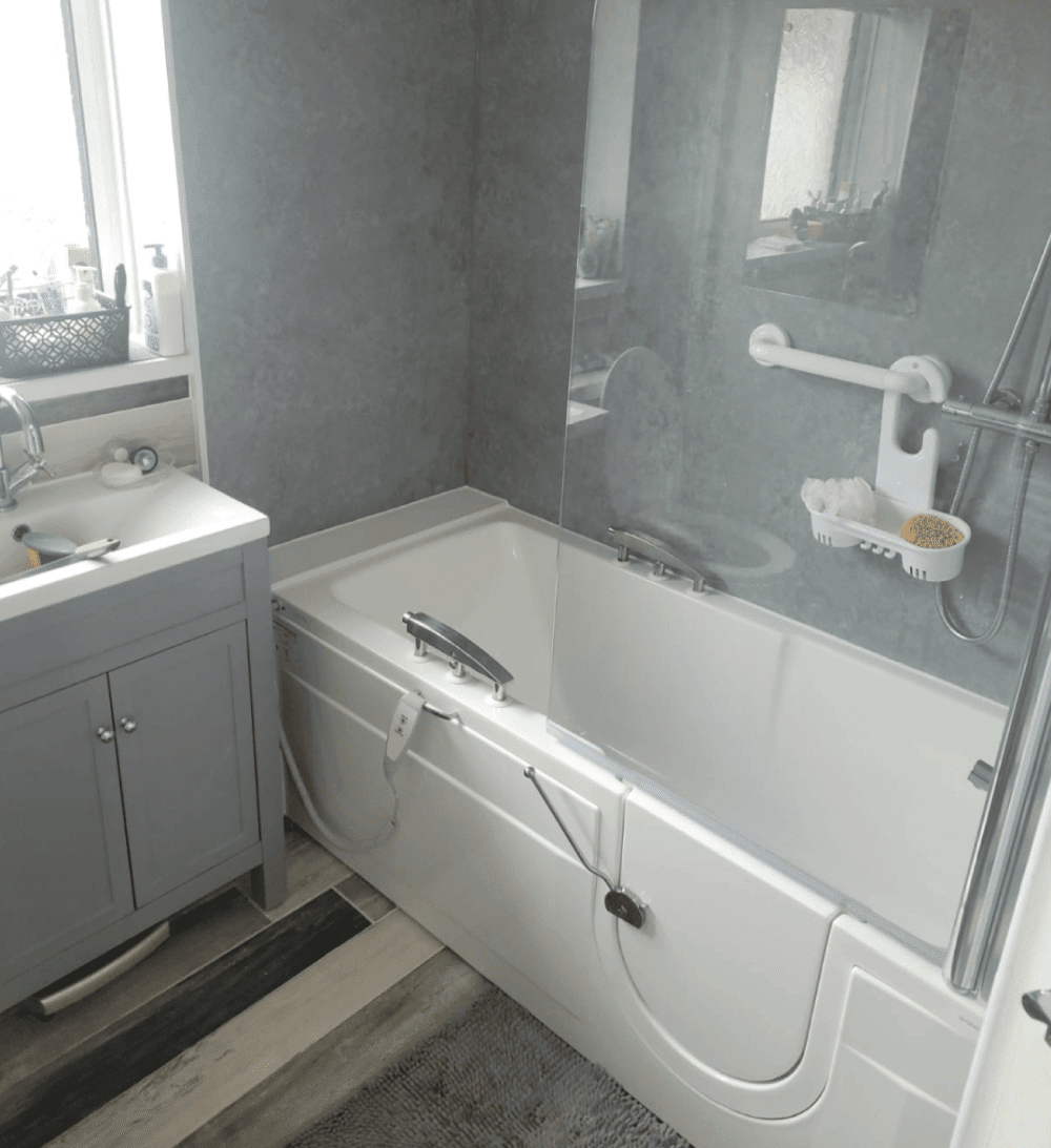 Mrs W, Stoke-on-Trent - Before