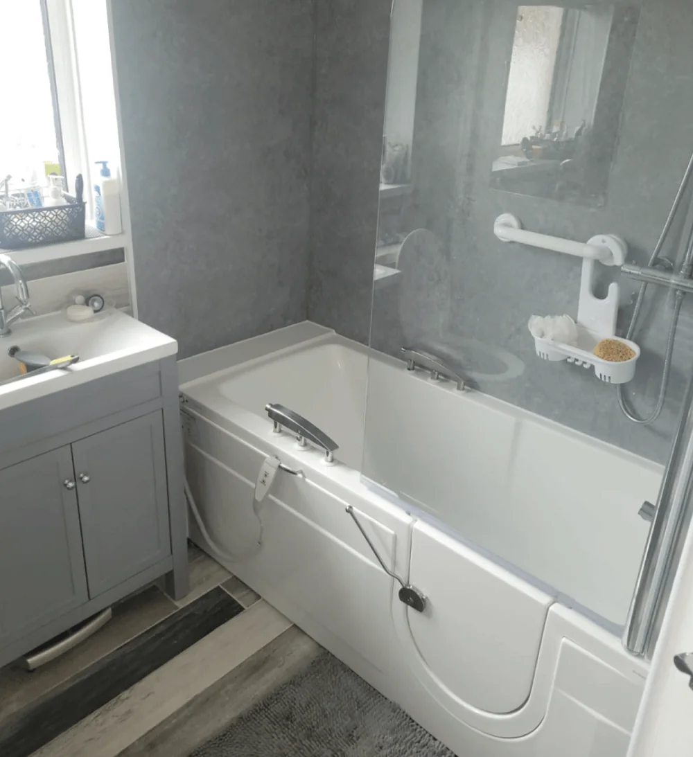 Mrs W, Stoke-on-Trent - Before